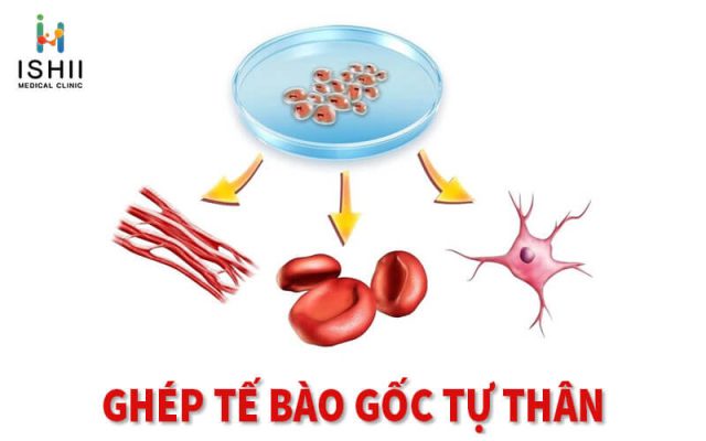 Ghép tế bào gốc tự thân