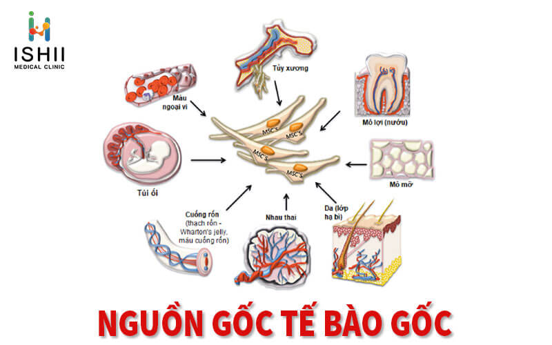 Nguồn tế bào gốc tự thân được lấy từ đâu?