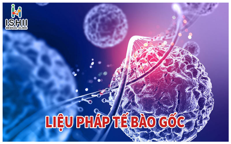 Liệu pháp tế bào gốc