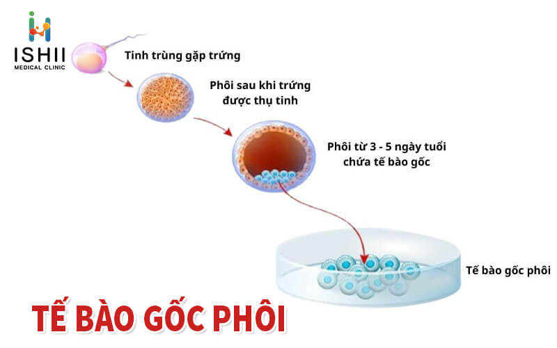 Tế bào gốc phôi