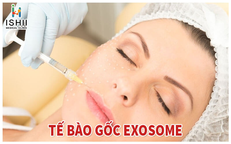 Tế bào gốc Exosome