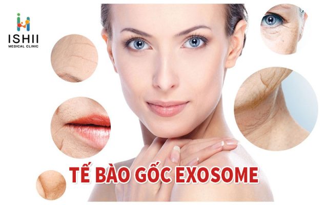 Tế bào gốc Exosome