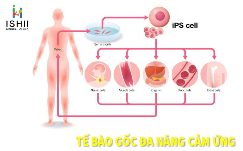 Tế bào gốc đa năng cảm ứng