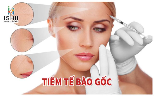 Tiêm tế bào gốc