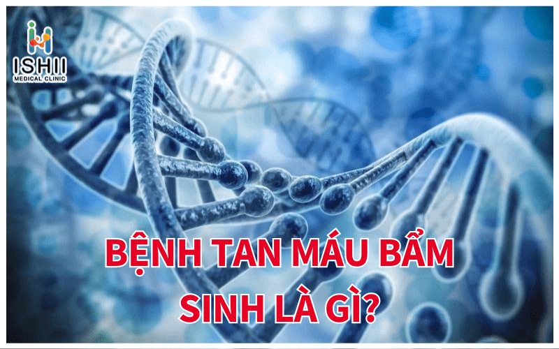 Bệnh tan máu bẩm sinh là gì?