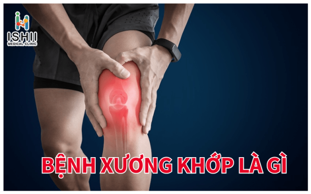 Bệnh xương khớp là gì