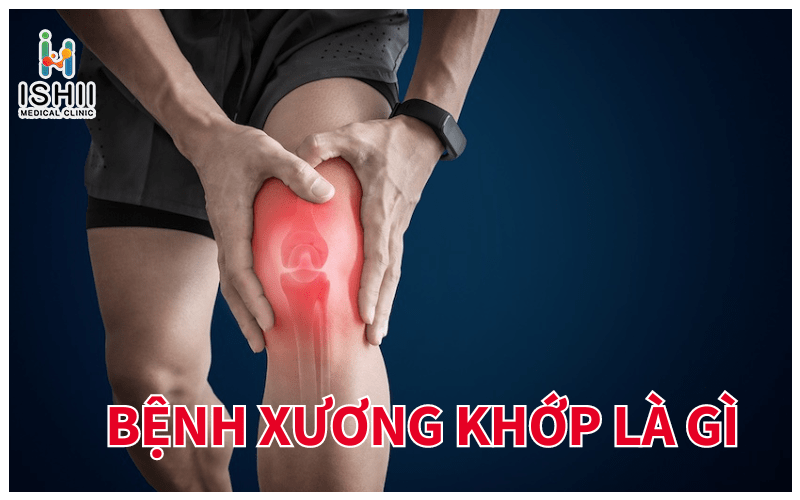 Bệnh xương khớp là gì?