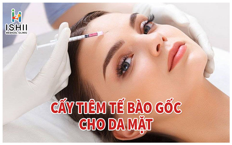 Cấy tế bào gốc cho da mặt