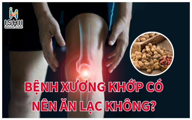 Người mắc bệnh xương khớp có nên ăn lạc không? 