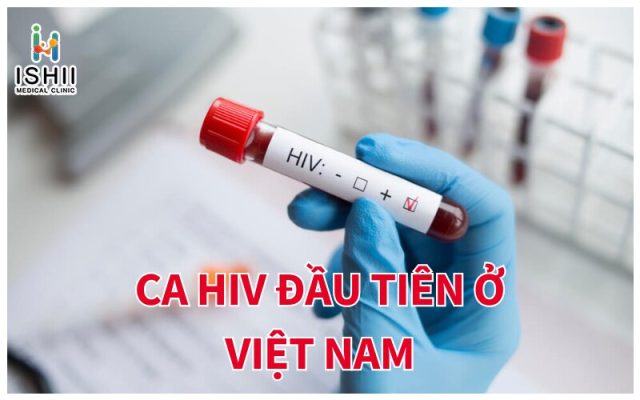 Ca HIV đầu tiên ở Việt Nam