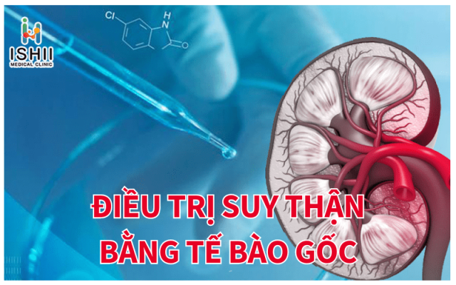 Điều trị suy thận bằng tế bào gốc