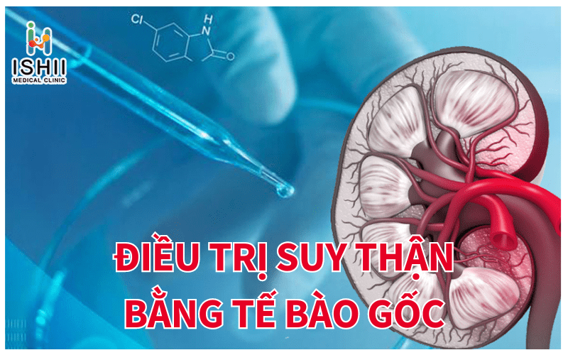 Điều trị suy thận bằng tế bào gốc từ nước tiểu