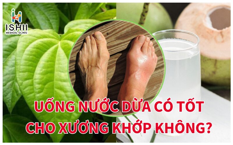 Uống nước dừa có tốt cho xương khớp không?